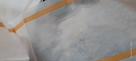 محافظ ریشه فرش مدل 9