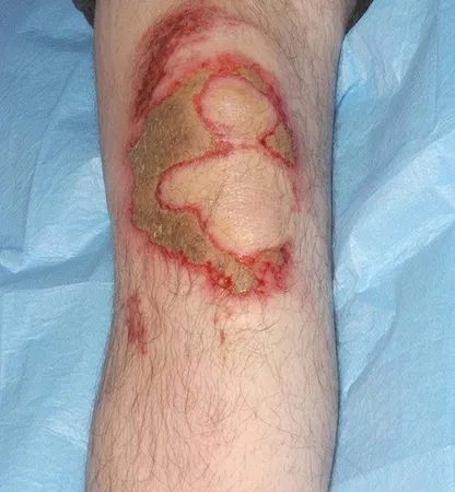 زانوبند طبی زاپیامکس مدل حرارتی