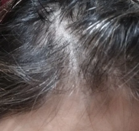 تونیک ضد ریزش مو سریتا مدل مینوتا حجم 50 میلی لیتر