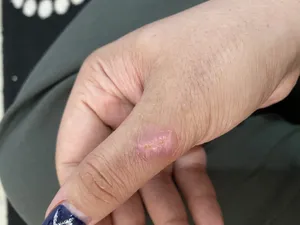 تجریه خرید کرم ترمیم کننده سی گل مدل میموزا 10 درصد مناسب انواع پوست حجم 30 میلی لیتر