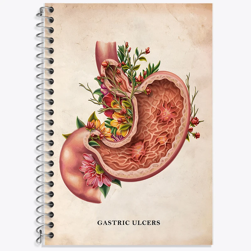 دفتر نت موسیقی 50 برگ خندالو طرح بیماری زخم معده (Gastric Ulcers) کد F13978