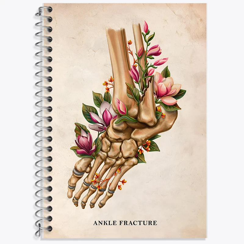 دفتر زبان دوخط 50 برگ خندالو طرح شکستگی مچ پا (Ankle Fracture) کد F13981
