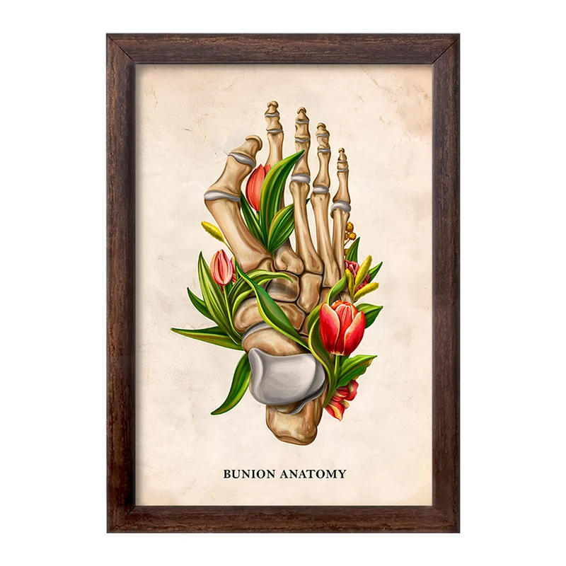 تابلو خندالو طرح آناتومی بونیون (Bunion Anatomy) کد F13987
