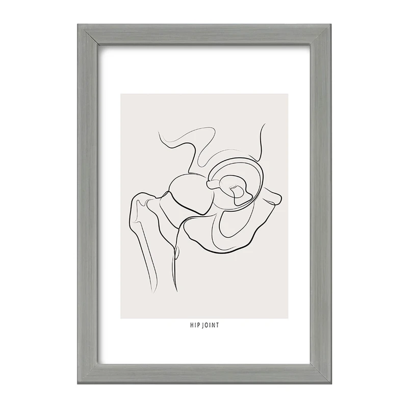 تابلو خندالو طرح مفصل ران (Hip Joint) کد F13913