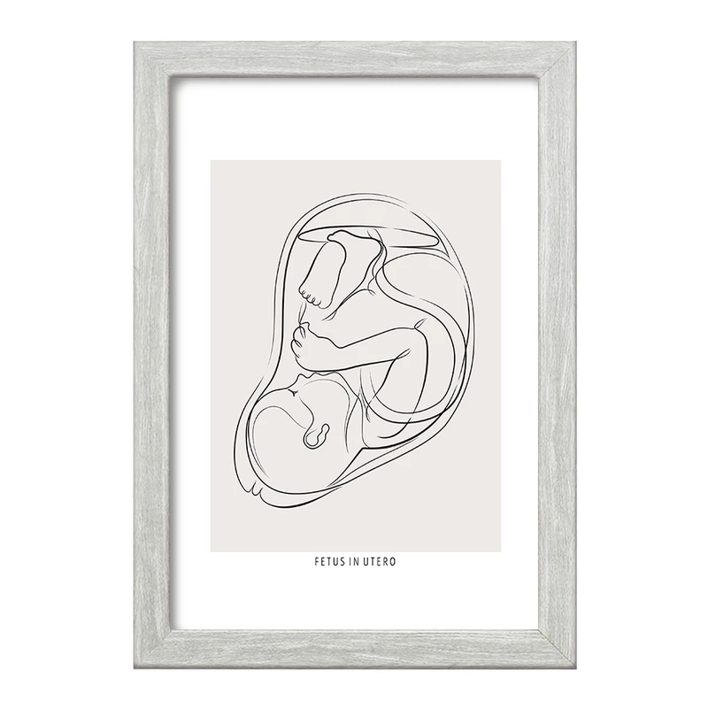 تابلو خندالو طرح جنین (Fetus In Utero) کد F13935