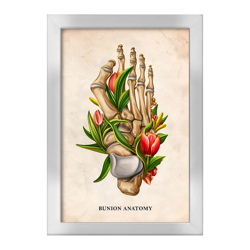 تابلو خندالو طرح آناتومی بونیون (Bunion Anatomy) کد F13987