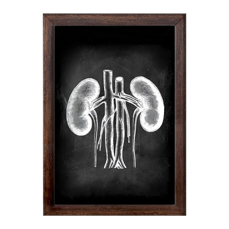 تابلو خندالو طرح آناتومی کلیه (kidney Anatomy) کد F13959