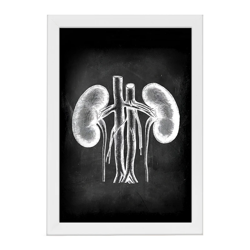 تابلو خندالو طرح آناتومی کلیه (kidney Anatomy) کد F13959