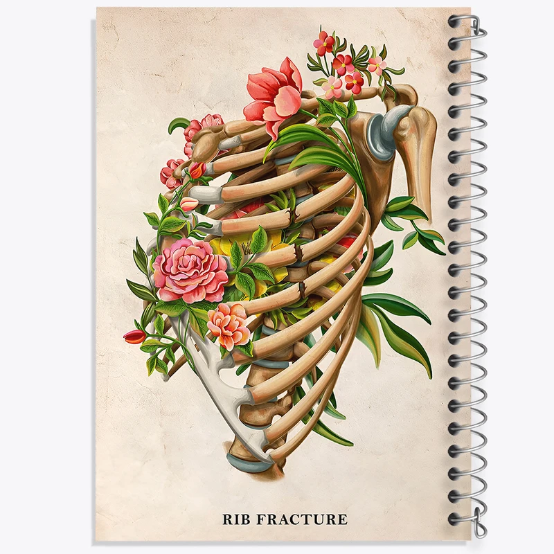دفتر نقاشی 50 برگ خندالو طرح شکستگی دنده (Rib Fracture) کد F13979