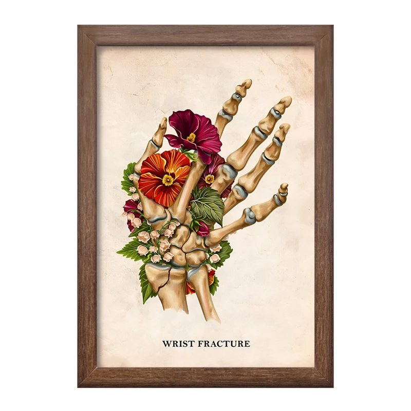 تابلو خندالو طرح شکستگی مچ دست (Wrist Fracture) کد F13988