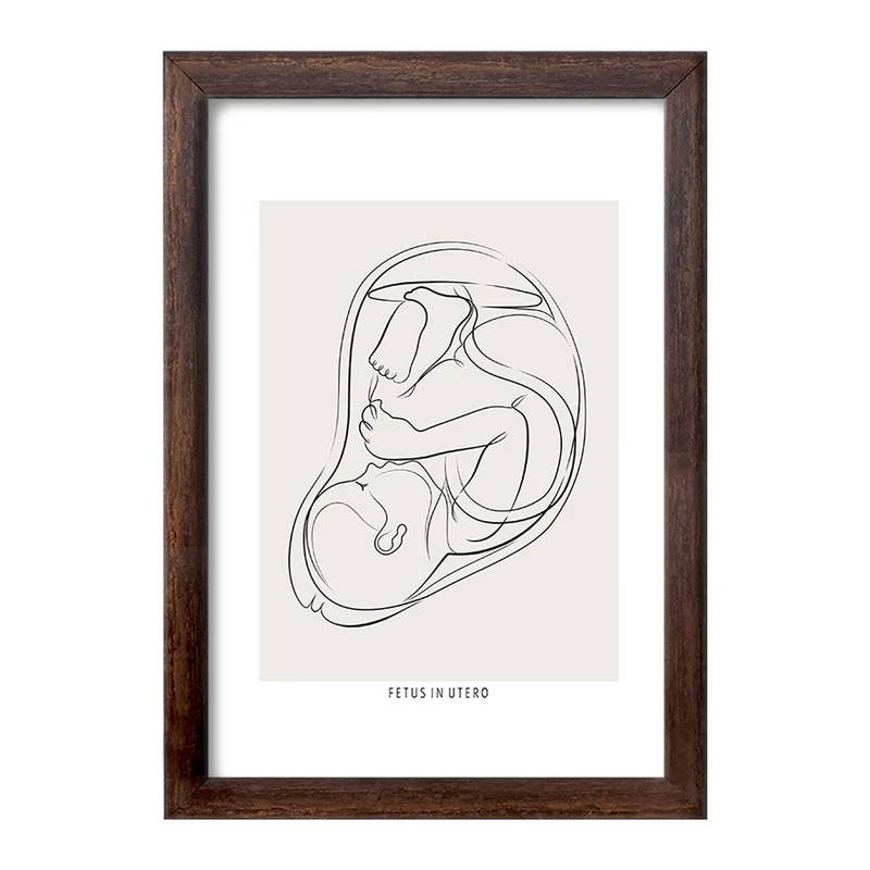 تابلو خندالو طرح جنین (Fetus In Utero) کد F13935