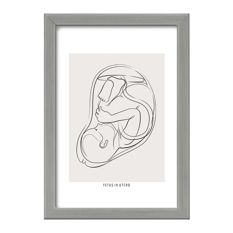 تابلو خندالو طرح جنین (Fetus In Utero) کد F13935
