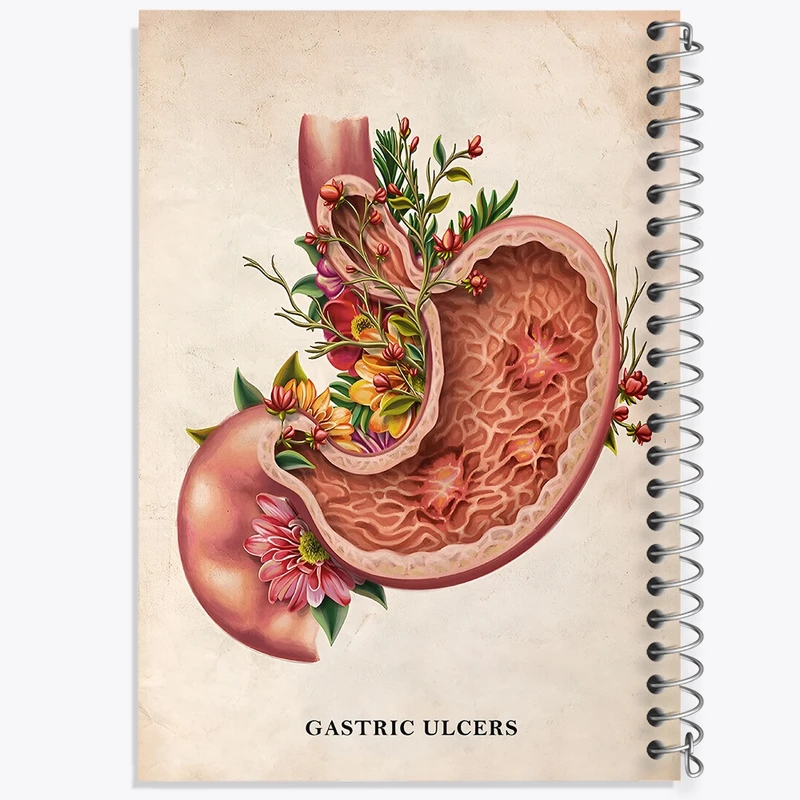 دفتر طراحی 50 برگ خندالو طرح بیماری زخم معده (Gastric Ulcers) کد F13978