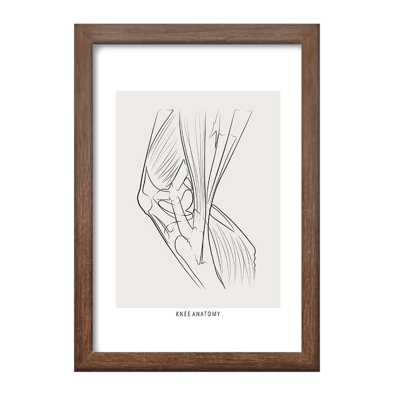 تابلو خندالو طرح آناتومی زانو (Knee Anatomy) کد F13925