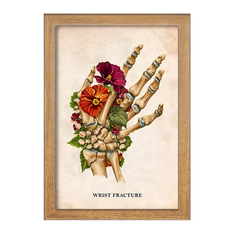 تابلو خندالو طرح شکستگی مچ دست (Wrist Fracture) کد F13988