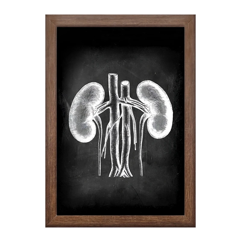 تابلو خندالو طرح آناتومی کلیه (kidney Anatomy) کد F13959