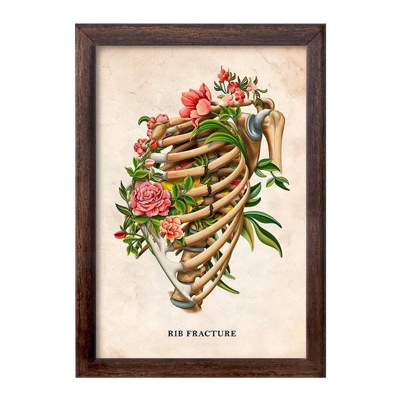 تابلو خندالو طرح شکستگی دنده (Rib Fracture) کد F13979