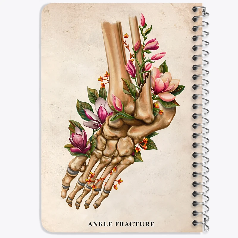 دفتر یادداشت 50 برگ خندالو طرح شکستگی مچ پا (Ankle Fracture) کد F13981