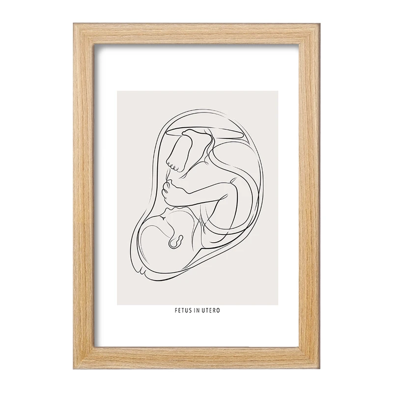 تابلو خندالو طرح جنین (Fetus In Utero) کد F13935