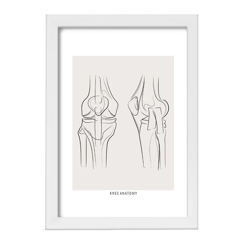 تابلو خندالو طرح آناتومی زانو (knee Anatomy) کد F13916
