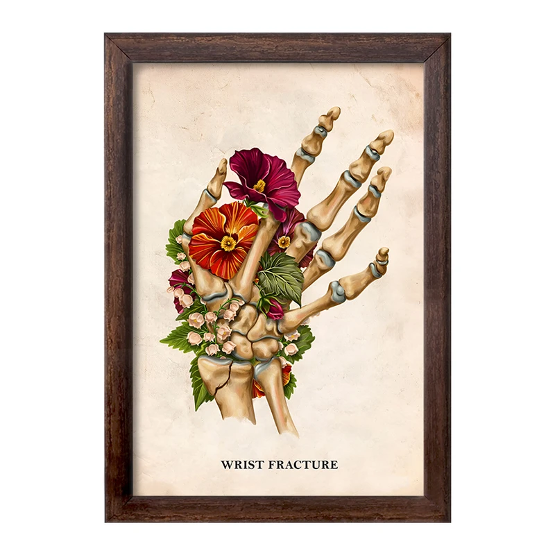 تابلو خندالو طرح شکستگی مچ دست (Wrist Fracture) کد F13988