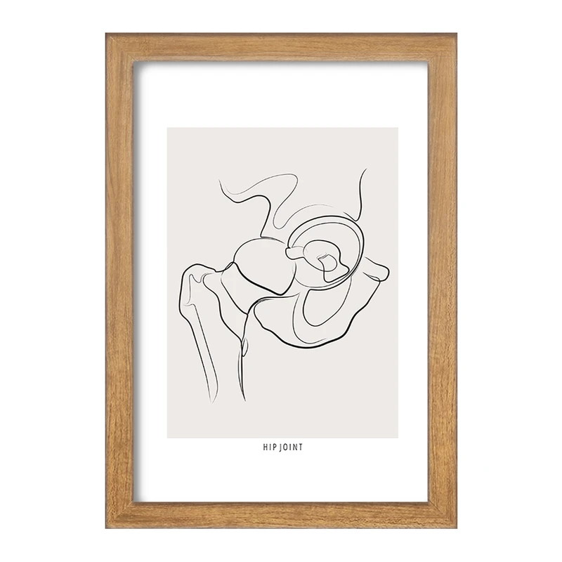 تابلو خندالو طرح مفصل ران (Hip Joint) کد F13913