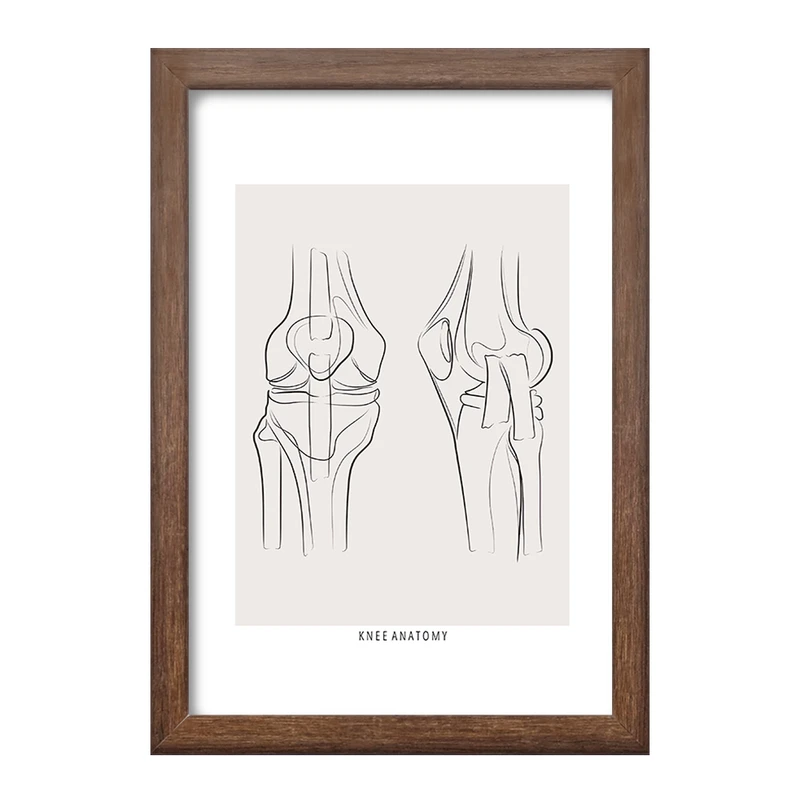 تابلو خندالو طرح آناتومی زانو (knee Anatomy) کد F13916