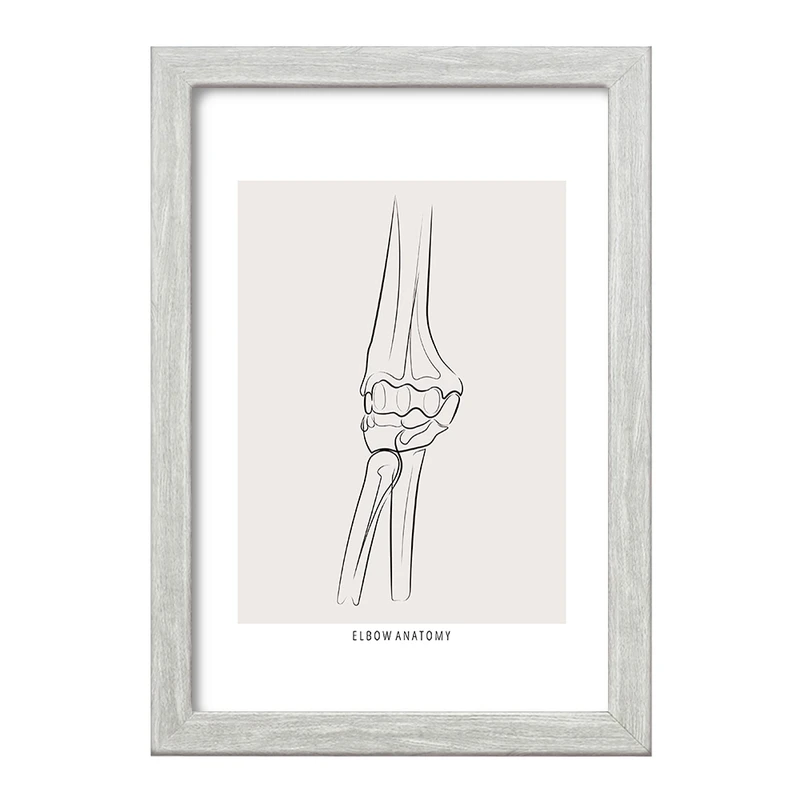 تابلو خندالو طرح آناتومی آرنج (Elbow Anatomy) کد F13914