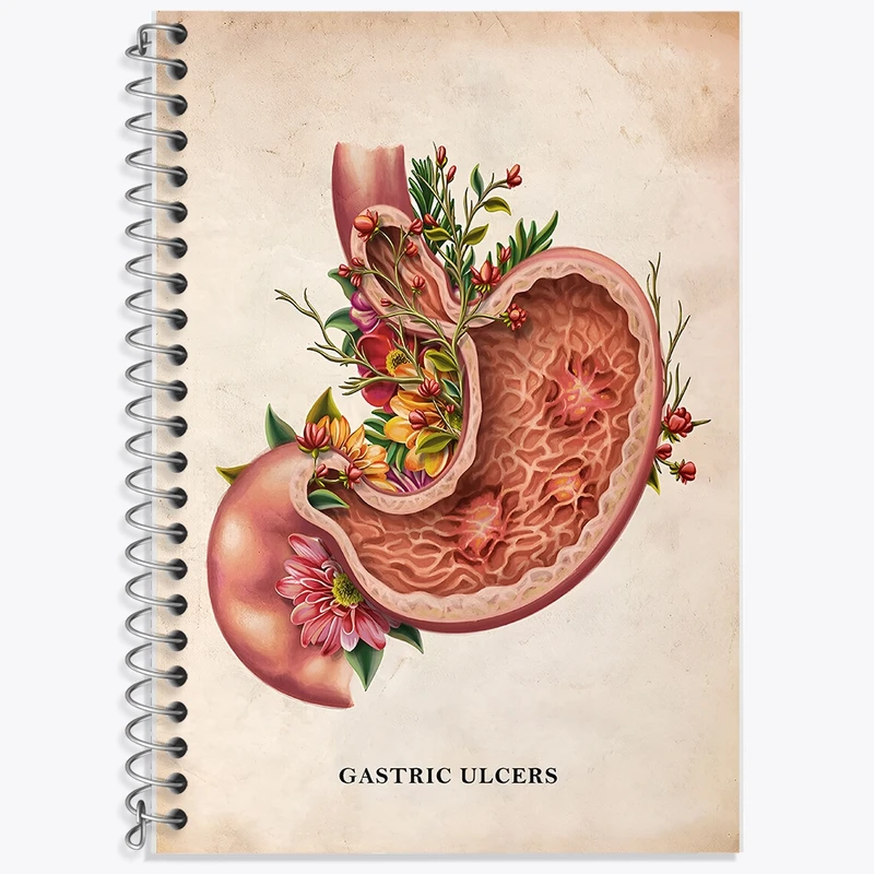 دفتر لغت 50 برگ خندالو طرح بیماری زخم معده (Gastric Ulcers) کد F13978