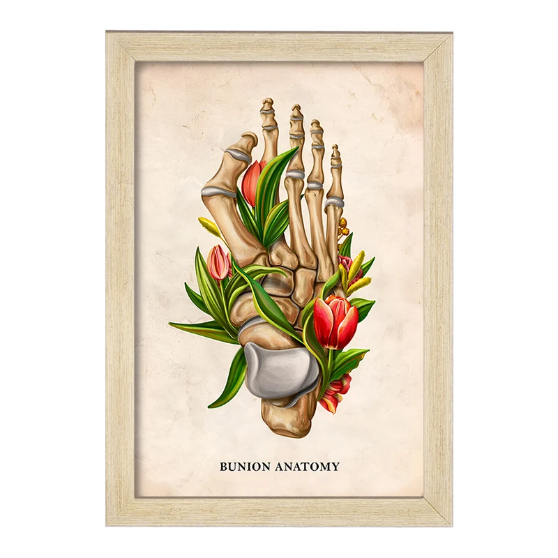 تابلو خندالو طرح آناتومی بونیون (Bunion Anatomy) کد F13987