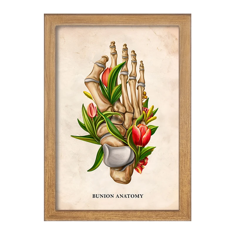 تابلو خندالو طرح آناتومی بونیون (Bunion Anatomy) کد F13987
