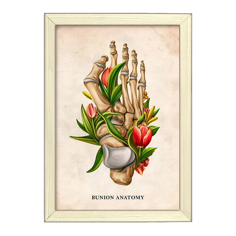 تابلو خندالو طرح آناتومی بونیون (Bunion Anatomy) کد F13987
