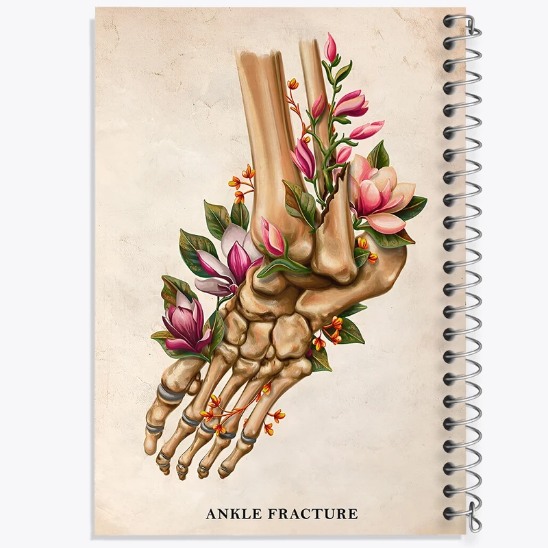 دفتر شطرنجی 50 برگ خندالو طرح شکستگی مچ پا (Ankle Fracture) کد F13981