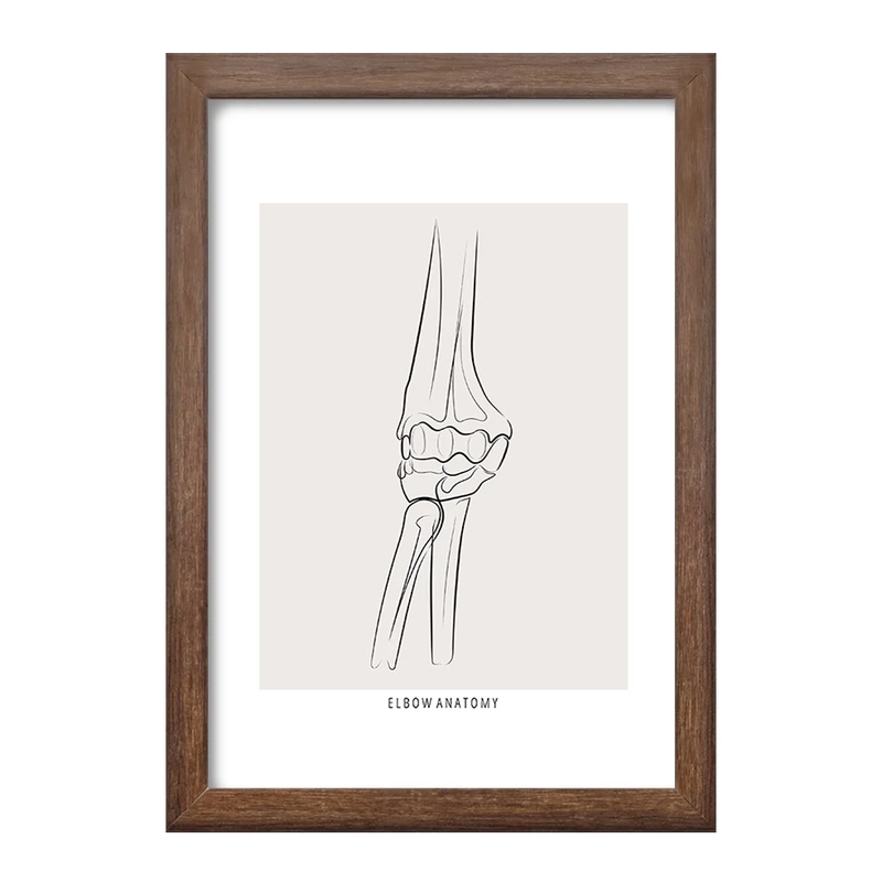 تابلو خندالو طرح آناتومی آرنج (Elbow Anatomy) کد F13914