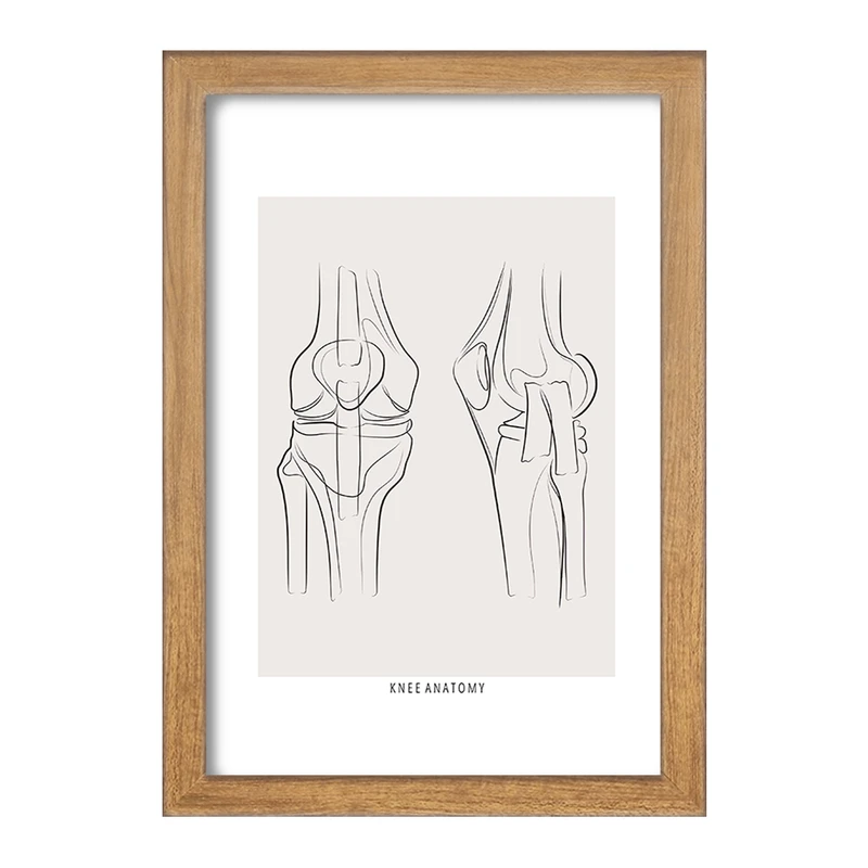 تابلو خندالو طرح آناتومی زانو (knee Anatomy) کد F13916