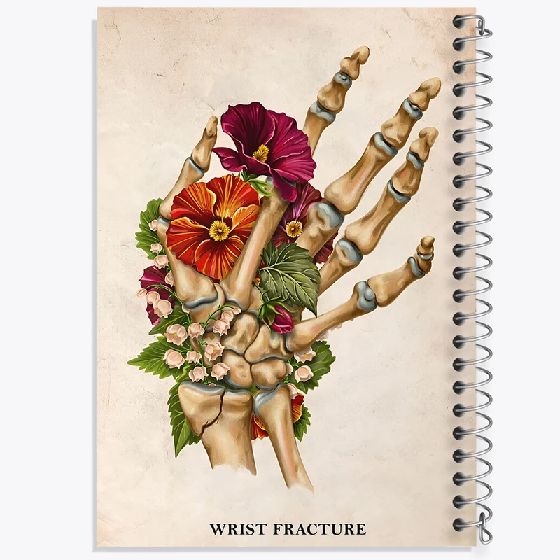 دفتر نقاشی 50 برگ خندالو طرح شکستگی مچ دست (Wrist Fracture) کد F13988