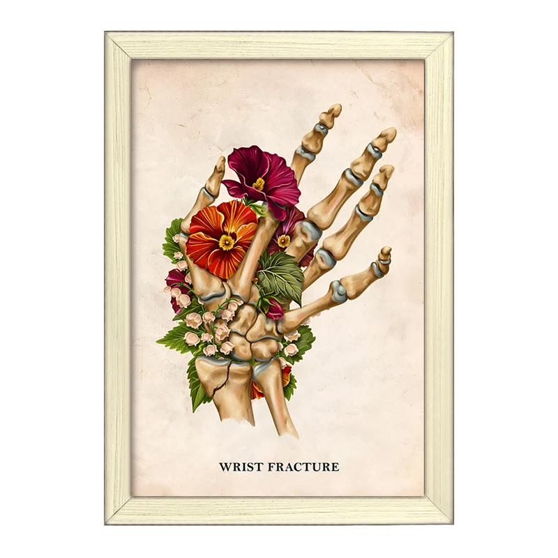 تابلو خندالو طرح شکستگی مچ دست (Wrist Fracture) کد F13988