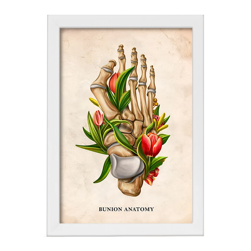 تابلو خندالو طرح آناتومی بونیون (Bunion Anatomy) کد F13987