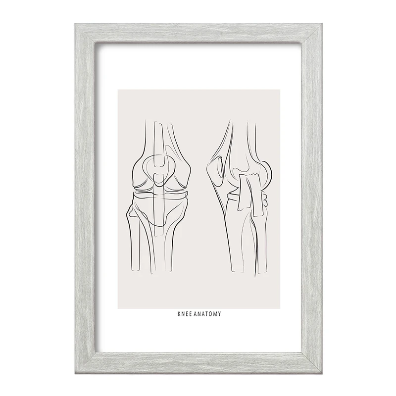 تابلو خندالو طرح آناتومی زانو (knee Anatomy) کد F13916