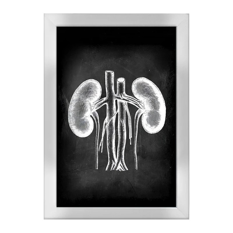 تابلو خندالو طرح آناتومی کلیه (kidney Anatomy) کد F13959