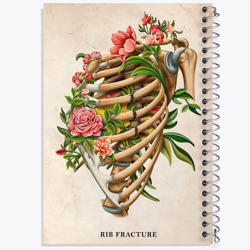 دفتر ژورنال نویسی 50 برگ خندالو مدل نقطه ای طرح شکستگی دنده (Rib Fracture) کد F13979