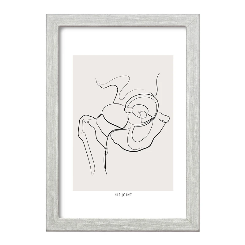 تابلو خندالو طرح مفصل ران (Hip Joint) کد F13913
