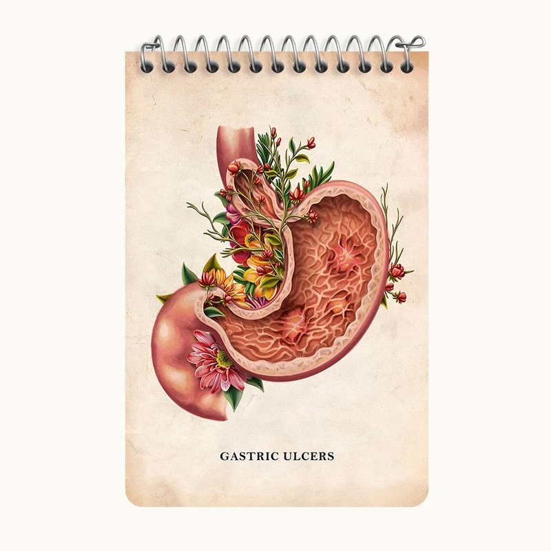 دفتر یادداشت 50 برگ خندالو طرح بیماری زخم معده (Gastric Ulcers) کد F13978