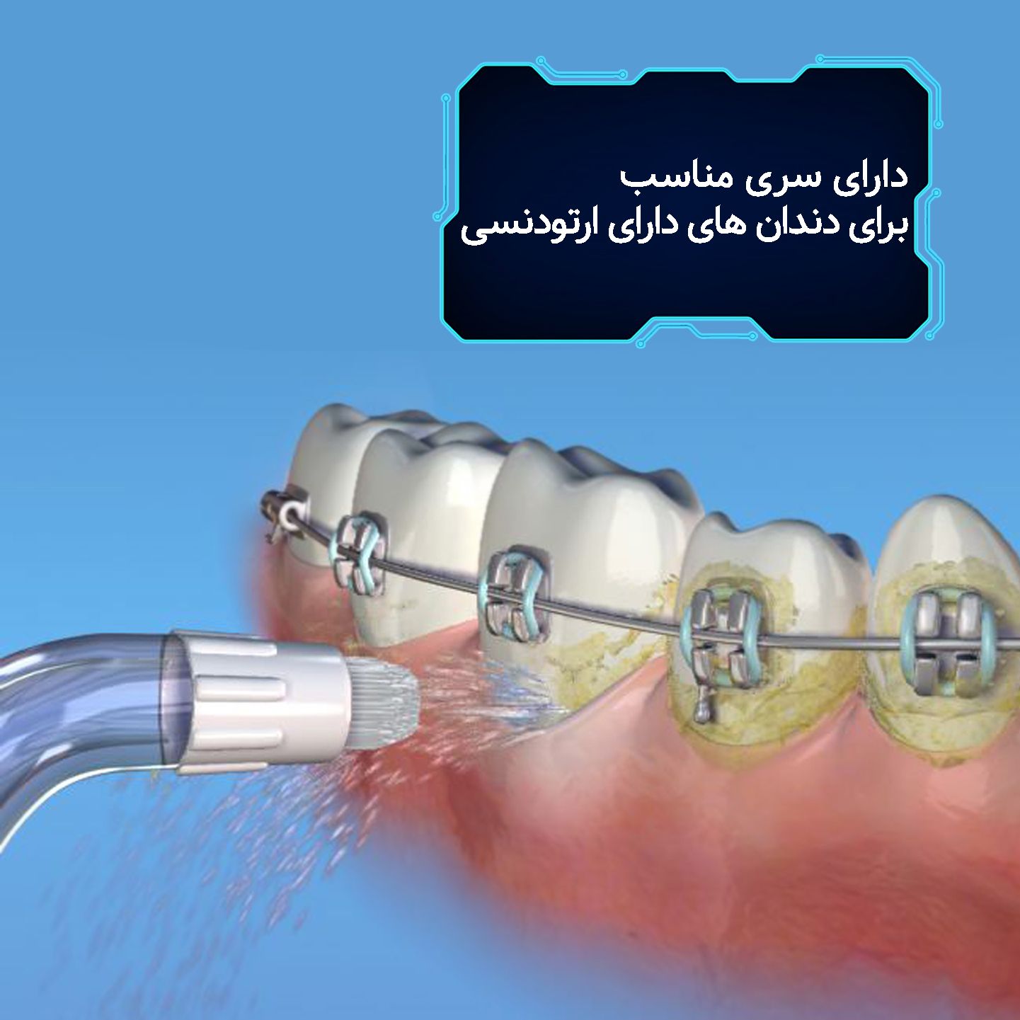 دستگاه شست و شوی دهان و دندان هارمن مدل MOTOJET AOW04 -  - 9