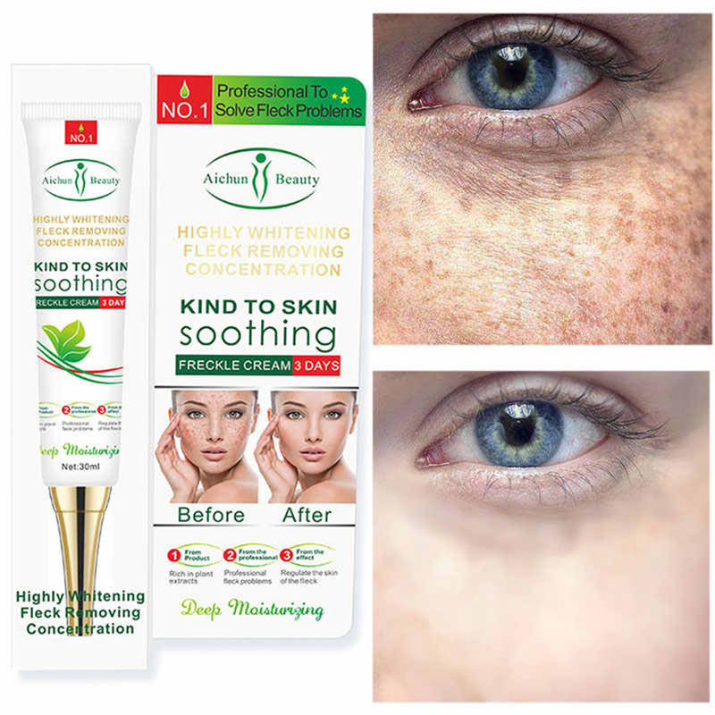 کرم ضد جوش آیچون بیوتی مدل SOOTHING حجم 30 میلی لیتر