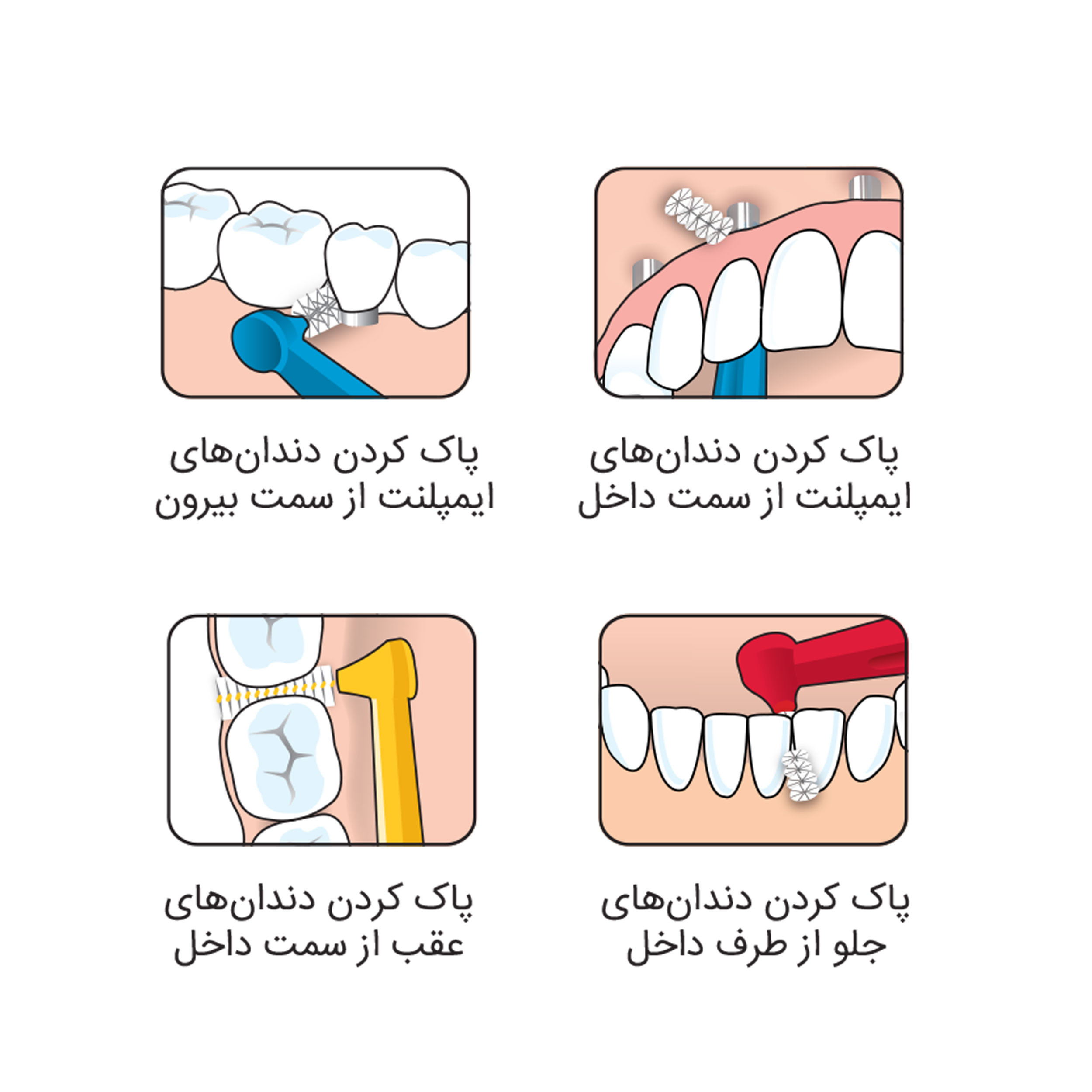 مسواک تهپه مدل IMPLANT ORTHO با برس متوسط به همراه مسواک بين دندانی تهپه مدل 001 مسواک تهپه مدل IMPLANT ORTHO با برس متوسط به همراه مسواک بين دندانی تهپه مدل 001