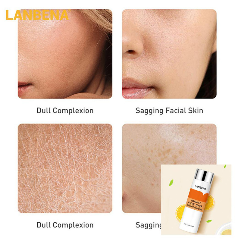 تونر پاک کننده صورت لنبنا مدل VITAMIN C حجم 100 میلی لیتر