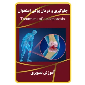 ویدئو آموزش جلوگیری و درمان پوکی استخوان نشر برج