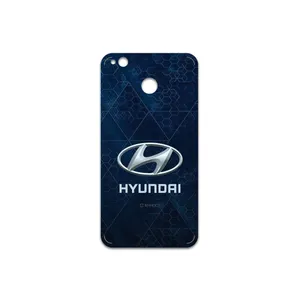 MAHOOT Hyundai Cover Sticker for Xiaomi Redmi 4X