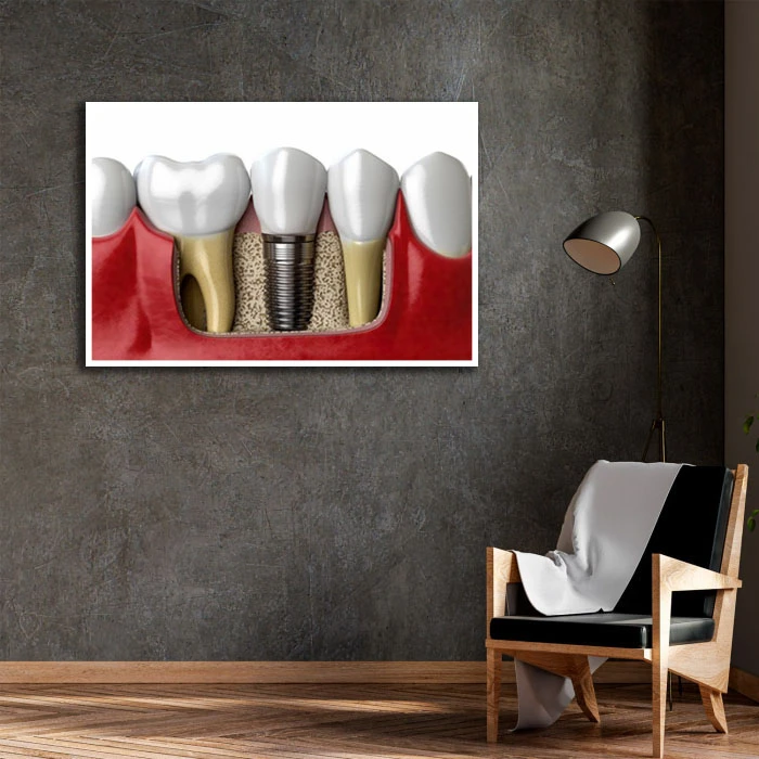 تابلو نوری بکلیت طرح دندان مدل W-D2203 فریم سفید